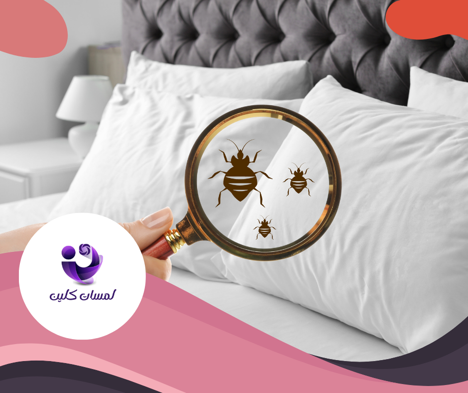 شركة مكافحة بق الفراش